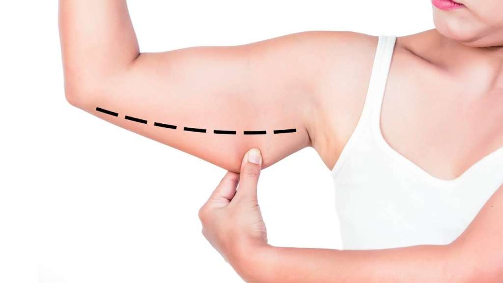 為什麼手臂總是瘦不下來