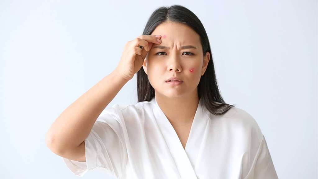 臉上突然「火山爆發」